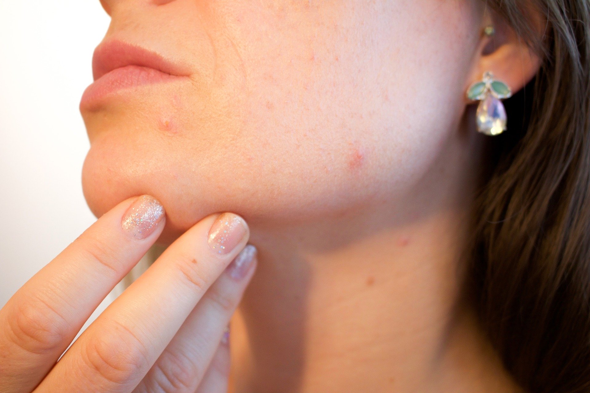 Medical Dermatology